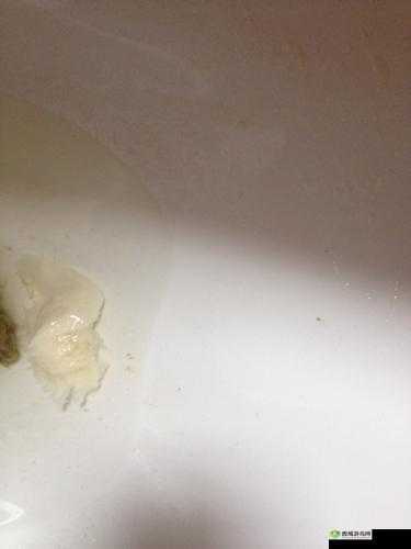 女生流出白白的东西怎么回事：原因分析