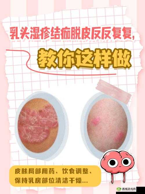 厨房里奶头被吸肿引发的状况